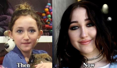 noah cyrus nose job|Nose jobs fall out of fashion as more patients are choosing non ...